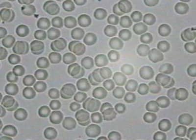 Picture A, without mobile phone Safer Call Study Blood Test A (M6)