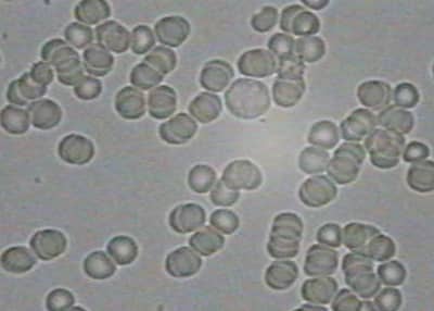 Picture A, without mobile phone