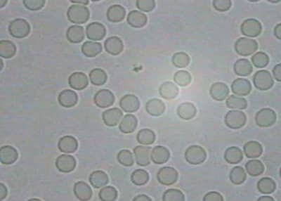 Picture A, without mobile phone